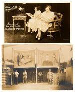 SIAMESE TWINS REAL PHOTO POSTCARD PAIR.