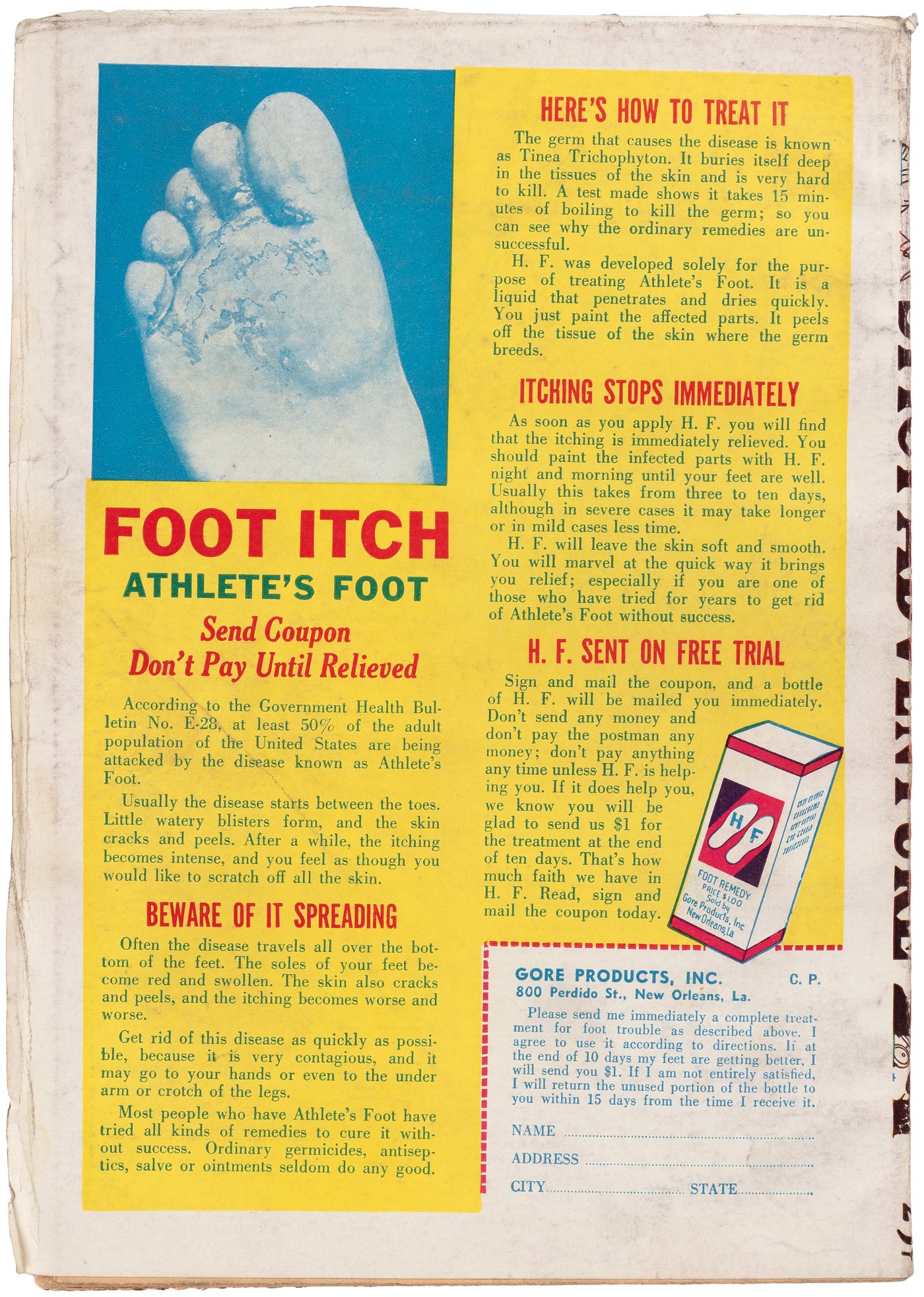 foot encapsulating trap - ADVENTURESS Magazine